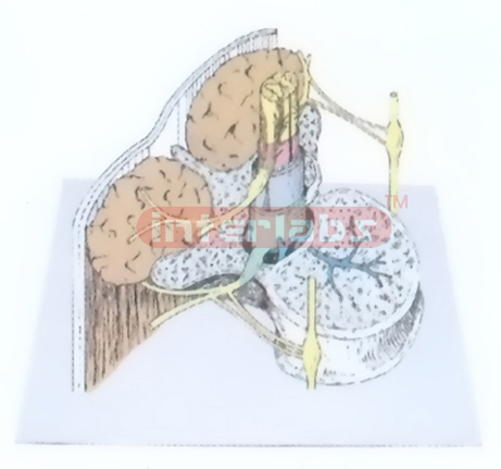 OBIGUE SECTION THROUGH THE FIRST LUMBAR, VERTEBRA SHOING THE SPINAL CORD AND ITS COVERING MEMBRANES